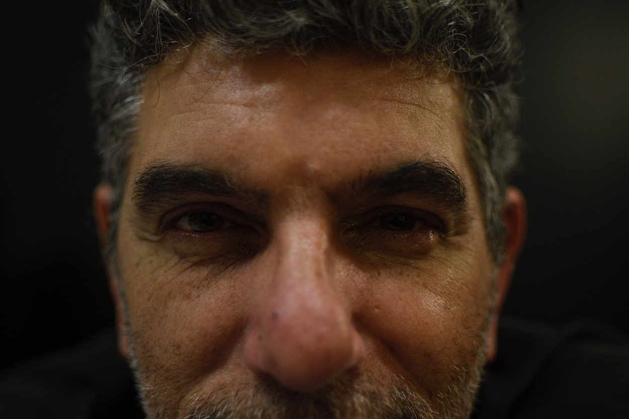 Rejuvenecimiento facial, la clave puede estar en la mirada