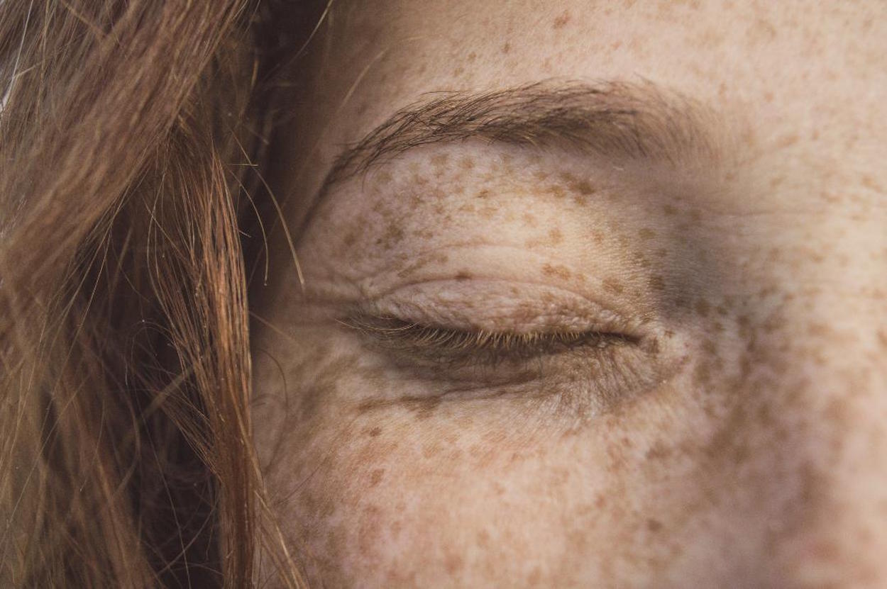 Protege tu piel este verano y elimina las manchas con los mejores tratamientos