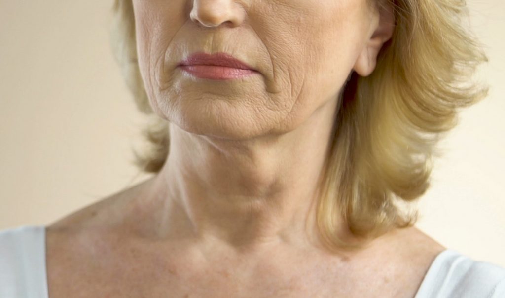 Abordando la flacidez facial en la mujer madura