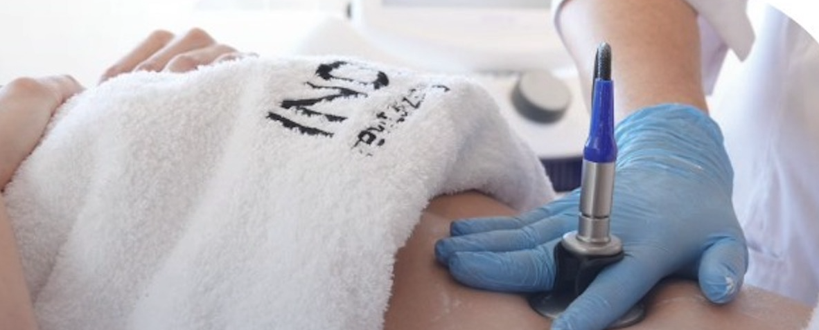 La radiofrecuencia, un clásico de la medicina estética, en apoyo de la cirugía